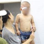 2 ขวบ ยังน่าห่วง อ้วกพุ่ง-มึนงง แม่เล่านาที อาสาตร. ดักใช้กระบองฟาด ลูกหัวแตก