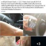 สาวผวา Smart Watch กำลังขับรถ ส่งลูกไปเรียน จู่ๆ ข้อมือเลือดพุ่ง แผลลึก
