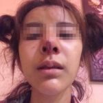 คบ2เดือน ทำร้าย 3รอบ! แฟนตีนโหด เตะหน้าสาวจมูกทะลุ แค่ปลดบล็อกเฟซผู้ชาย
