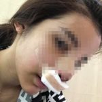 คบ2เดือน ทำร้าย 3รอบ! แฟนตีนโหด เตะหน้าสาวจมูกทะลุ แค่ปลดบล็อกเฟซผู้ชาย