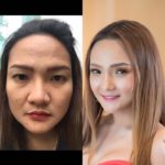 สาวช้ำ! เพื่อนล้ออ้วนดำ-เลิกผัว ทุ่มเงินล้าน เปลี่ยนร่าง-ทุบหน้าใหม่ จนสวยขนาดนี้