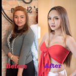 สาวช้ำ! เพื่อนล้ออ้วนดำ-เลิกผัว ทุ่มเงินล้าน เปลี่ยนร่าง-ทุบหน้าใหม่ จนสวยขนาดนี้