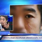 สาวสุดช้ำ! โดนผัวเก่า-เมียใหม่รุมยำเละหน้าโรงพัก ข้องใจผัวอดีตทหารไม่ถูกจับ