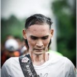 'แซม' นักวิ่งสู้มะเร็ง เผยอาการสุดเจ็บปวด เตรียมผ่าตัด หลังโรคร้ายฟื้นคืนรอบ 10ปี