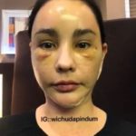 โชว์หน้าใหม่! แหม่ม วิชุดา บินทุบหน้ารอบ 3 กระชากวัยเด็กลงไปอีก