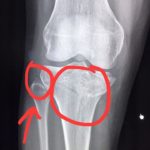 สายลับ นักกีฬาขี่ม้าทีมชาติตกม้าระหว่างซ้อม ส่อพักยาว ชวดลุยคิงส์คัพ