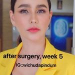 โชว์หน้าใหม่! แหม่ม วิชุดา บินทุบหน้ารอบ 3 กระชากวัยเด็กลงไปอีก