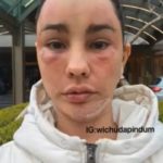 โชว์หน้าใหม่! แหม่ม วิชุดา บินทุบหน้ารอบ 3 กระชากวัยเด็กลงไปอีก