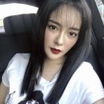แก้มบุ๋ม ถุงซีสต์แตก เลือดออกในช่องท้อง แพทย์ดูแลอย่างใกล้ชิด