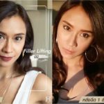 ชะลอวัยเร่งด่วน เรื่องจริงหรือแค่โฆษณา ฟังกูรูด้านปัญหาผิว (คลิป)