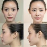 ชะลอวัยเร่งด่วน เรื่องจริงหรือแค่โฆษณา ฟังกูรูด้านปัญหาผิว (คลิป)