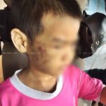 พ่อแท้ๆรุดเยี่ยม ด.ช. 6 ขวบ เหยื่อแม่ตีน่วม ดีใจลูกปลอดภัย-ไม่ติดเชื้อเอดส์