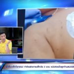กรรชัย ของขึ้น-หลุดฉะพี่เลี้ยงโหด ทุบ 2 ขวบก้านสมองตาย กัดยันอัณฑะ-น่วมทั้งตัว