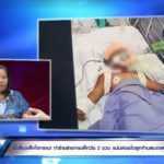 กรรชัย ของขึ้น-หลุดฉะพี่เลี้ยงโหด ทุบ 2 ขวบก้านสมองตาย กัดยันอัณฑะ-น่วมทั้งตัว