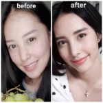 เฌอเบลล์ แก้จมูกใหม่ หวั่นฟิลเลอร์ปลอมทำตาบอด ทุ่ม 4 แสน แลกความปลอดภัย