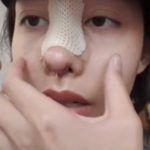 เฌอเบลล์ แก้จมูกใหม่ หวั่นฟิลเลอร์ปลอมทำตาบอด ทุ่ม 4 แสน แลกความปลอดภัย