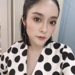 นาทีเฉียดตาย! แก้มบุ๋ม หมาชน เลือดออกซ้ำ กลัวเหมือนผ่าคลอดอีก - ซึ้งใจ พีท