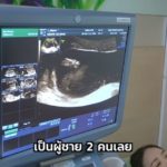 บีม เครียด หมอเตือนภาวะครรภ์แฝด เจอดราม่า พาเมียเปิดใจ ห่วงลูกโตโดนล้อ(คลิป)