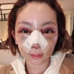 ฮารุ รีวิวพลีชีพ ศัลยกรรมต้องที่เกาหลี จริงป่าว ห่วงลูกจำแม่ไม่ได้ เปิดราคาซื้อรถได้(คลิป)