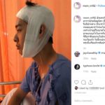 หม่อมเอ็ม ตัดสินใจครั้งใหญ่ในชีวิต ให้หมอลงมีดผ่าตัดขากรรไกร