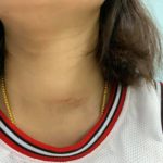 สาวโวย โจรบุกห้อง ต่อยหน้าเลือดสาด-บีบคอ ชิงทรัพย์ รีสอร์ตโคราช ปัดรับผิดชอบ  