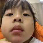 กุ๊บกิ๊บ แทบทรุด! เป่าเปา เลือดกบปากเย็บ 15เข็ม ซิ่งเข้ากทม.ส่งรพ.ด่วน