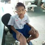 ช่วยระทึก เด็กชายเผลอซด น้ำยาล้างห้องน้ำ เตือนผู้ปกครอง ภัยใกล้ตัวที่ต้องระวัง