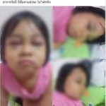 แม่ร้อง ลูกสาวตัวน้อย แค่บวกเลขช้า ครูฉุน ใช้ไม้ฟาดกลางหัว หน้าบวม ตาปิด