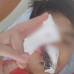 หวาดเสียว สาวทอมสุดโหด มีเรื่องกันในผับ ต่อย-คว้ากุญแจรถ ปักเข้าที่เบ้าตา!