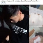 หวาดเสียว สาวทอมสุดโหด มีเรื่องกันในผับ ต่อย-คว้ากุญแจรถ ปักเข้าที่เบ้าตา!