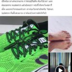 ต้องไม่กลัวมัน เมฆ วินัย ตุ่มน้ำพอง ขึ้นอีก ดับฝัน ลุ้นแต่ละวัน จะโผล่ตรงไหน