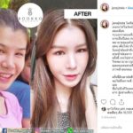 แก๊งแม่แพท บุกศัลยกรรมเกาหลี เปลี่ยนชุดใหญ่ - เปิดหน้าใหม่แล้ว เจน สวยมากๆ (คลิป)