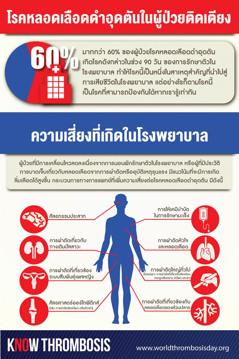 หลอดเลือดดำอุดตัน
