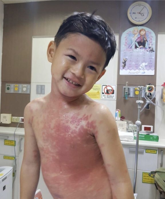 ฮารุ ฮารุ