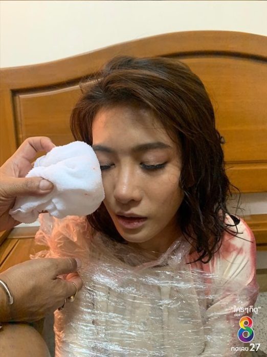 ไอซ์-อธิชนัน เกิดอุบัติเหตุ