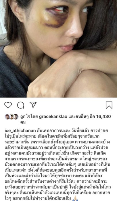 ไอซ์ 