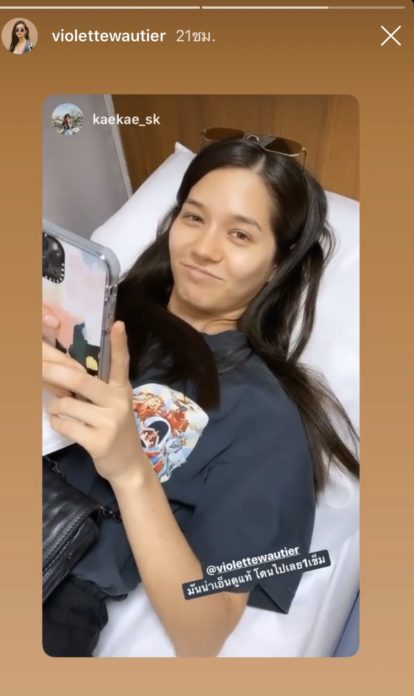 วี วิโอเลต เส้นเสียงบวม