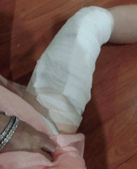 ซวยซ้ำซ้อน ซวยซ้ำซ้อน