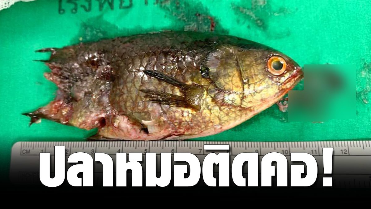 คนหาปลา คาบปลาหมอไว้หลังจับได้ ดิ้นหลุดติดคอหอย หมอช่วยระทึก - ข่าวสด คนหาปลา คาบปลาหมอไว้หลังจับได้ ดิ้นหลุดติดคอหอย หมอช่วยระทึก - ข่าวสด