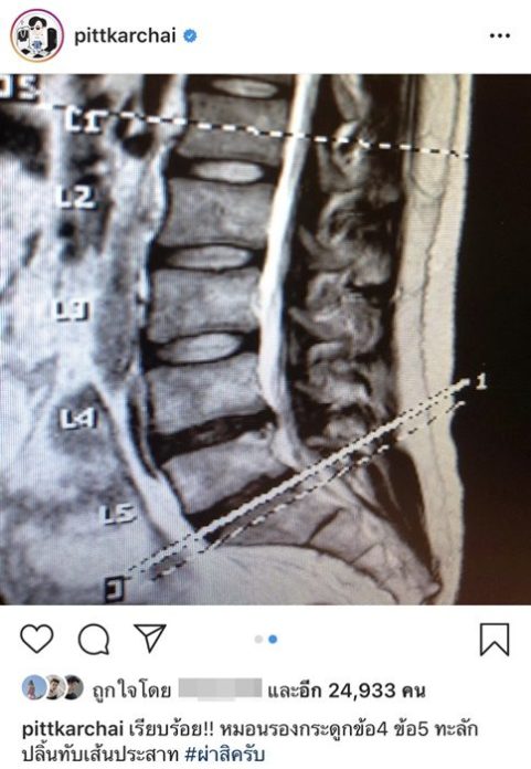 พิชญ์ กาไชย เตรียมตัวผ่าตัดครั้งใหญ่