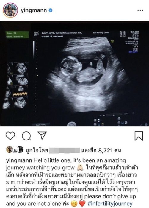 เฮลั่น!! หญิงแม้น โพสต์ภาพอัลตราซาวด์ ตั้งครรภ์