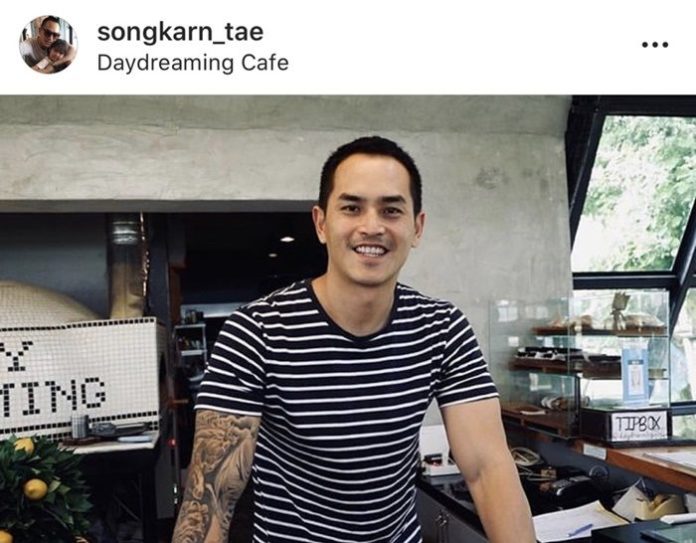 สงกรานต์ เผยภาพผ่าตัดหัวเข่า หลังปล่อยยื้ดเยื้อ