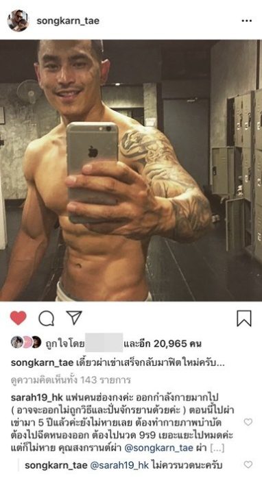 สงกรานต์ เผยภาพผ่าตัดหัวเข่า หลังปล่อยยื้ดเยื้อ