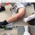 หนุ่มนอนเจ็บอยู่ที่พื้น สาวขับรถชน ไม่ช่วยแล้วยังดูถูกทำงานก่อสร้าง ด่าเล่นละครเก่ง