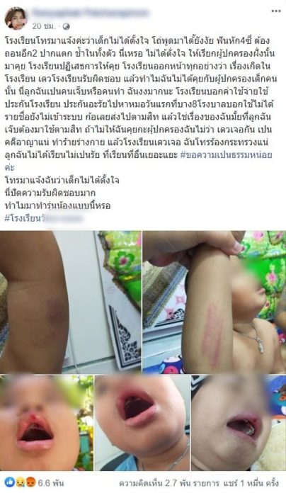 พี่แกล้ง