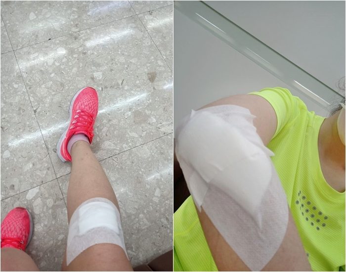 สภาพของผู้บาดเจ็บหลังเกิดเหตุ