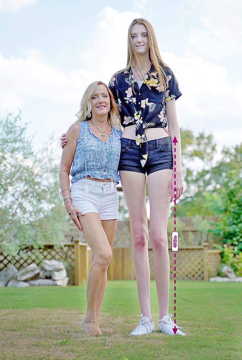 หญิงขายาวที่สุดในโลก