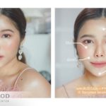 “New Modern Facelift 2021” บอกลาปัญหาเหี่ยวย่น ด้วย 3 เทคนิคศัลยกรรม เพื่อใบหน้าอ่อนเยาว์อย่างเป็นธรรมชาติ