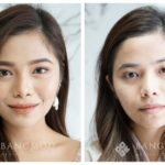 “New Modern Facelift 2021” บอกลาปัญหาเหี่ยวย่น ด้วย 3 เทคนิคศัลยกรรม เพื่อใบหน้าอ่อนเยาว์อย่างเป็นธรรมชาติ