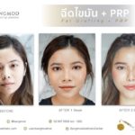 “New Modern Facelift 2021” บอกลาปัญหาเหี่ยวย่น ด้วย 3 เทคนิคศัลยกรรม เพื่อใบหน้าอ่อนเยาว์อย่างเป็นธรรมชาติ